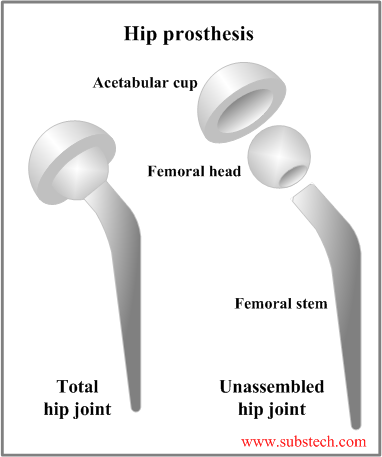 Hip prosthesis.png